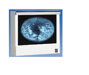 SKU: 131790 VuPlus Mammography Viewer, Single