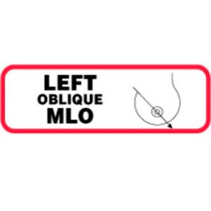 LEFT OBLIQUE MLO Paper Label